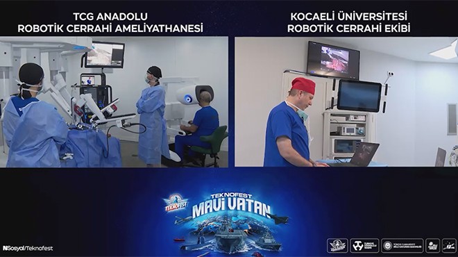 TCG ANADOLU’DA 5G DESTEKLİ ROBOTİK CERRAHİ